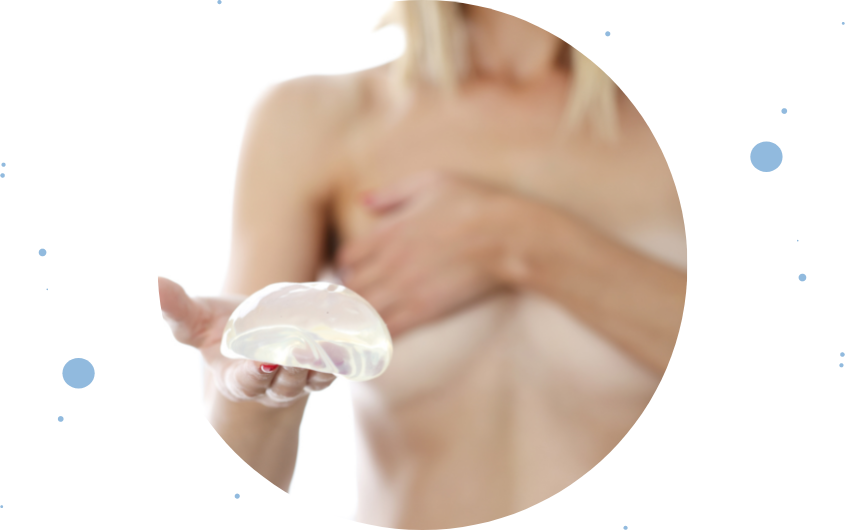 Mamoplastia